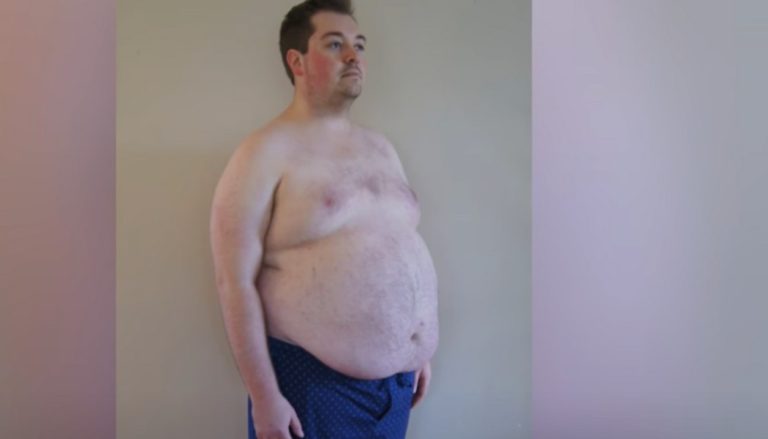 This Doctor Lost 125 Pounds By Intermittent Fasting With The 16:8 Method